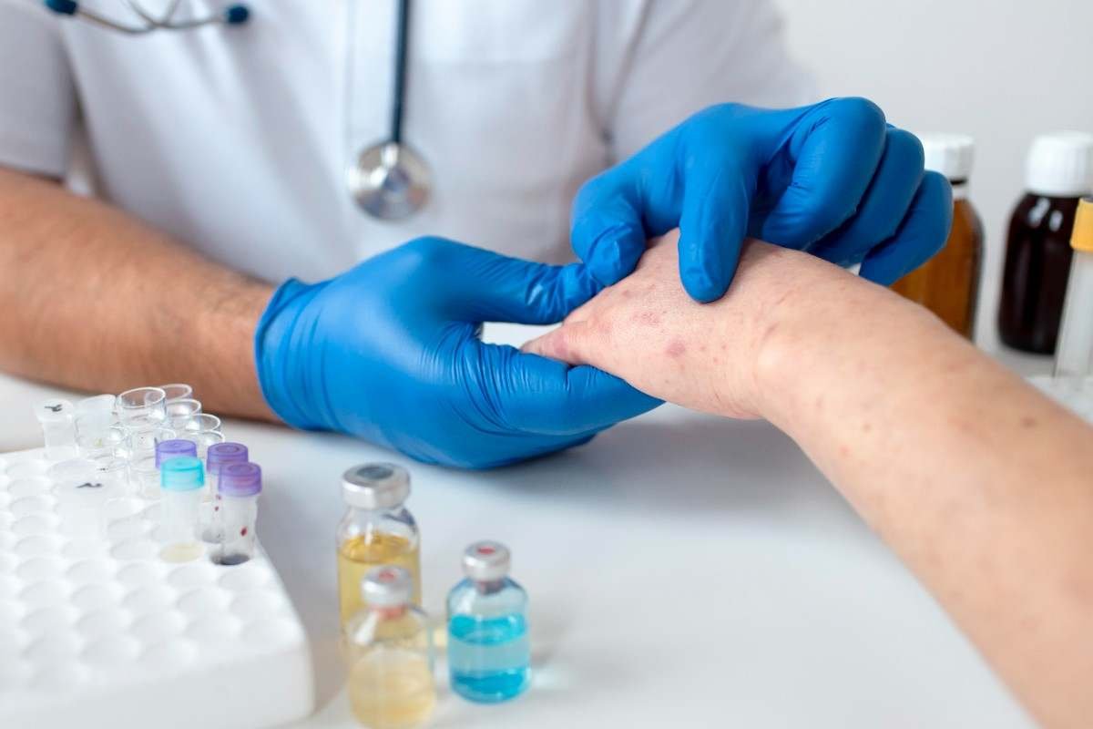 Fungal Infection Treatment